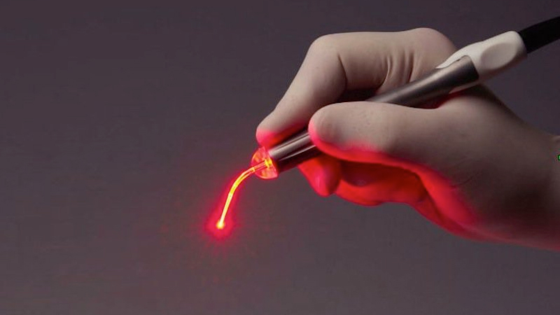 Aplicação de Laser Odontológico