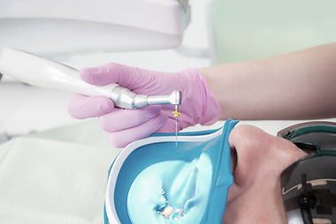 Root Canal Treatment_edited.jpg
